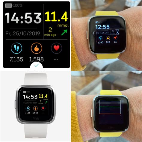 Quick Overview: THE PERFECT COMPANION for your <b>Apple</b> <b>Watch</b> series 1, 2, <b>3</b>, (42mm), and Series 4, $24. . Freestyle libre 3 apple watch